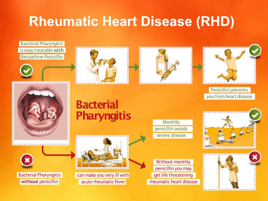 The RHD Program